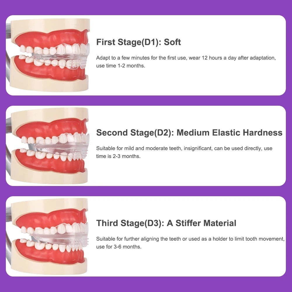 Dental Aligner Braces- Orthodontic Teeth Alignment Brace Trainer