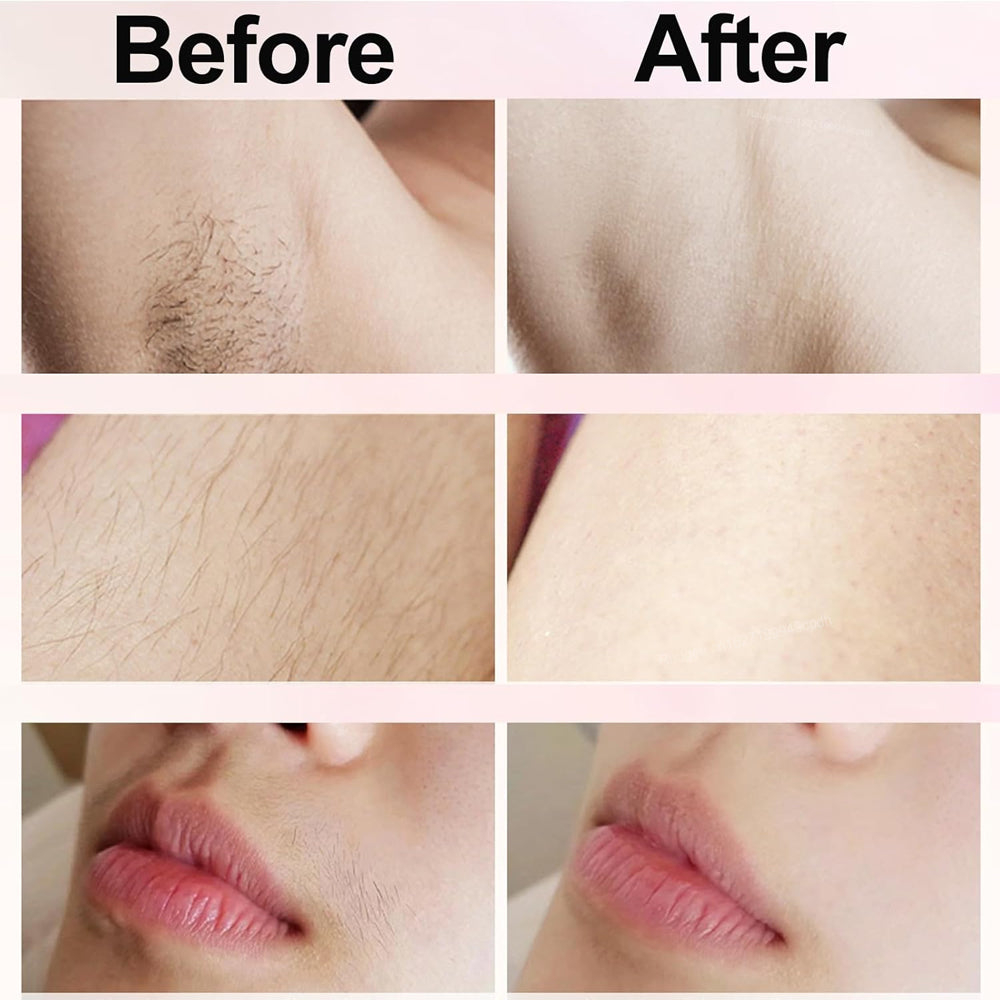 Gentle Electric Hair Trimmer For Women - Best Bikini Trimmer for Women