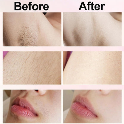 Gentle Electric Hair Trimmer For Women - Best Bikini Trimmer for Women