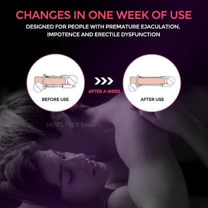 Men's Performance Enhancer Traction Device